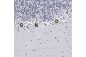 Immunohistochemical staining of human cerebellum with FAM207A polyclonal antibody  shows strong cytoplasmic positivity(granular pattern) in Purkinje cells at 1:200-1:500 dilution. (FAM207A 抗体)