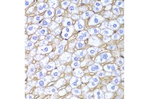 Immunohistochemistry of paraffin-embedded mouse liver using HLA-A antibody at dilution of 1:100 (400x lens). (HLA-A 抗体)