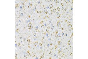 Immunohistochemistry of paraffin-embedded rat brain using LRPAP1 Antibody (ABIN5971543) at dilution of 1/200 (40x lens). (LRPAP1 抗体)