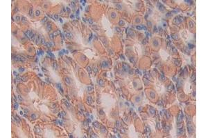 Detection of IL11Ra in Mouse Stomach Tissue using Polyclonal Antibody to Interleukin 11 Receptor Alpha (IL11Ra)