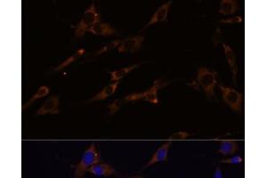 Immunofluorescence analysis of C6 cells using RPL7A Polyclonal Antibody at dilution of 1:100 (40x lens). (RPL7A 抗体)