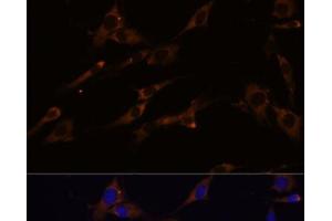 Immunofluorescence analysis of C6 cells using RPL7A Polyclonal Antibody at dilution of 1:100 (40x lens).