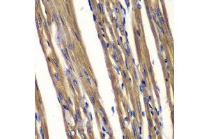Immunohistochemistry (Paraffin-embedded Sections) (IHC (p)) image for anti-Protein tyrosine Phosphatase, Non-Receptor Type 2 (PTPN2) (AA 1-353) antibody (ABIN3022585)
