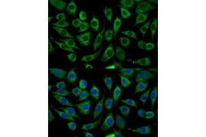 Immunofluorescence analysis of L929 cells using  Polyclonal Antibody (ABIN7266299) at dilution of 1:100 (40x lens). (CCL17 抗体  (AA 420-500))