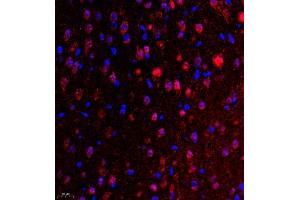 Immunofluorescence of paraffin embedded mouse brain using UBE3A (ABIN7076105) at dilution of 1:650 (400x lens) (ube3a 抗体)