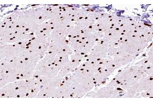 ABIN6267590 at 1/200 staining human Smooth muscle tissue sections by IHC-P. (MEF2A 抗体  (pThr312))