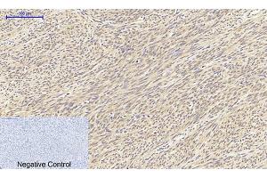 Immunohistochemical analysis of paraffin-embedded human uterus tissue. (TGFB1 抗体  (AA 310-390))