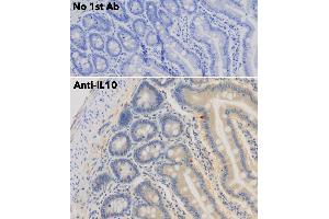 Immunohistochemistry (IHC) image for anti-Interleukin 10 (IL10) antibody (ABIN6254177)