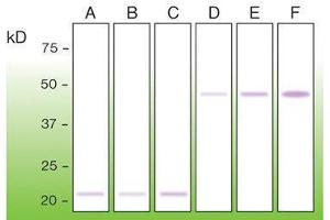 Western Blotting (WB) image for anti-BCL2-Associated X Protein (BAX) (N-Term) antibody (ABIN870624) (BAX 抗体  (N-Term))