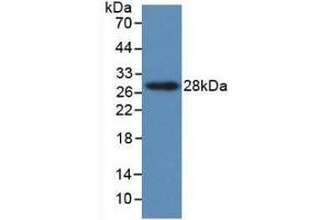 Detection of Recombinant PTHrP, Human using Monoclonal Antibody to Parathyroid Hormone Related Protein (PTHrP) (PTHLH 抗体  (AA 37-177))