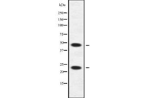 Western blot analysis of APOBEC3A/B using HuvEc whole cell lysates (APOBEC3A/B 抗体)