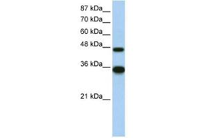 WB Suggested Anti-GTF2H4 Antibody Titration:  2. (GTF2H4 抗体  (N-Term))