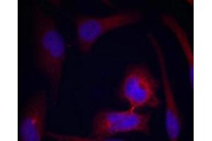 Immunofluorescence staining of methanol-fixed Hela cells using S6 Ribosomal Protein(Phospho-Ser235) Antibody. (RPS6 抗体  (pSer235))