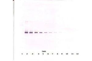 Image no. 1 for anti-serpin Peptidase Inhibitor, Clade I (neuroserpin), Member 1 (SERPINI1) antibody (ABIN465664) (Neuroserpin 抗体)