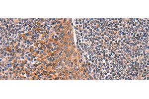 Immunohistochemistry of paraffin-embedded Human tonsil tissue using ACYP1 Polyclonal Antibody at dilution of 1:65(x200) (ACYP1 抗体)