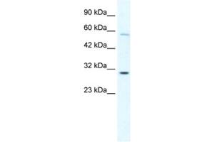 Western Blotting (WB) image for anti-GATA Zinc Finger Domain Containing 1 (GATAD1) antibody (ABIN2460670) (GATAD1 抗体)