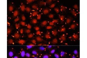 Immunofluorescence analysis of HeLa cells using ACAA1 Polyclonal Antibody at dilution of 1:100 (40x lens). (ACAA1 抗体)