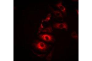 Immunofluorescent analysis of IL-21 staining in Hela cells. (IL-21 抗体)