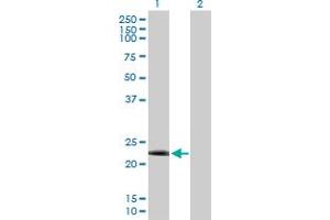 Western Blot analysis of DYDC2 expression in transfected 293T cell line by DYDC2 MaxPab polyclonal antibody. (DYDC2 抗体  (AA 1-177))