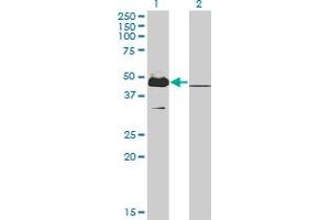 Western Blot analysis of MKRN2 expression in transfected 293T cell line by MKRN2 monoclonal antibody (M01), clone 5F8. (MKRN2 抗体  (AA 317-415))