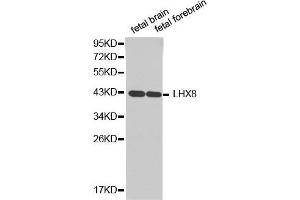 Western blot analysis of extracts of various cell lines, using LHX8antibody. (LHX8 抗体  (AA 1-220))