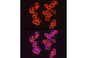 Immunofluorescence analysis of  cells using THBD Rabbit pAb (ABIN1683026, ABIN3018621, ABIN3018622 and ABIN6220518) at dilution of 1:50 (40x lens). (Thrombomodulin 抗体  (AA 200-500))