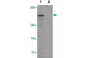 Western blot analysis of ATP2C1 in mouse brain tissue lysate with ATP2C1 polyclonal antibody  at 1 ug/mL in (1) the absence and (2) the presence of blocking peptide. (ATP2C1 抗体  (C-Term))