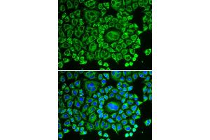 Immunofluorescence analysis of HeLa cells using ARHGDIA antibody. (ARHGDIA 抗体)