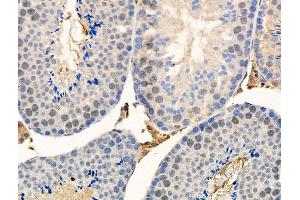Phospho-Ubiquitin (Ser65) Antibody at 1/100 staining Mouse testis tissue by IHC-P.
