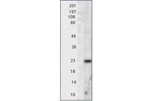Image no. 1 for anti-Superoxide Dismutase 2, Mitochondrial (SOD2) antibody (ABIN264858) (SOD2 抗体)