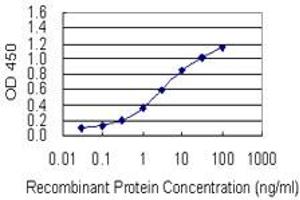 Detection limit for recombinant GST tagged RAI1 is 0. (RAI1 抗体  (AA 1-101))