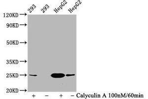 Western Blot Positive WB detected in 293 whole cell lysate,HepG2 whole cell lysate(treated with Calyculin A or not) All lanes Phospho-EIF4E antibody at 1. (Recombinant EIF4E 抗体  (pSer209))