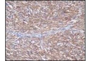 Immunohistochemistry (IHC) image for anti-Mast/stem Cell Growth Factor Receptor (KIT) (C-Term) antibody (ABIN870633) (KIT 抗体  (C-Term))