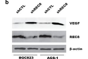 Depletion of REC8 enhanced HUVECs migration and tube formation through upregulation of VEGF in gastric cancer cells. (VEGFA 抗体  (AA 27-126))