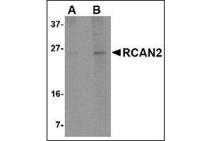 Western blot analysis of RCAN2 in 3T3 cell lysate with this product at (A) 1 and (B) 2 μg/ml. (RCAN2 抗体  (Center))