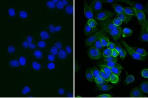 Human pancreatic carcinoma cell line MIA PaCa-2 was stained with Mouse Anti-Human CD44-UNLB, and DAPI. (兔 anti-小鼠 IgG (Heavy & Light Chain) Antibody (Alkaline Phosphatase (AP)))