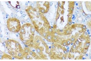Immunohistochemistry of paraffin-embedded Mouse kidney using ACOT2 Polyclonal Antibody at dilution of 1:100 (40x lens). (ACOT2 抗体)