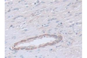 Detection of CAPNS1 in Human Prostate Tissue using Polyclonal Antibody to Calpain, Small Subunit 1 (CAPNS1)