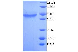 SDS-PAGE (SDS) image for Alcohol Dehydrogenase 5 (Class III), chi Polypeptide (ADH5) (AA 2-374) protein (His tag) (ABIN5713194)