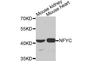 Western blot analysis of extracts of various cell lines, using NFYC antibody. (NFYC 抗体)