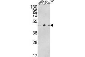 Western Blotting (WB) image for anti-ARP3 Actin-Related Protein 3 Homolog B (ACTR3B) antibody (ABIN3003796) (ACTR3B 抗体)