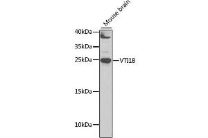 Western blot analysis of extracts of mouse brain, using VTI1B antibody. (VTI1B 抗体)