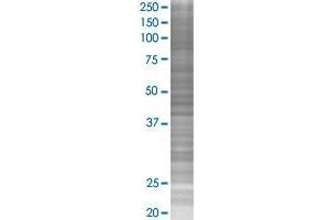 BMPR2 transfected lysate.