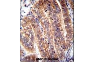 NUMB Antibody (N-term) (ABIN655396 and ABIN2844944) immunohistochemistry analysis in formalin fixed and paraffin embedded human uterus tissue followed by peroxidase conjugation of the secondary antibody and DAB staining. (NUMB 抗体  (N-Term))