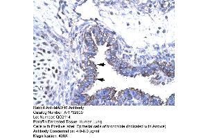 Human Lung (SMAD6 抗体  (N-Term))