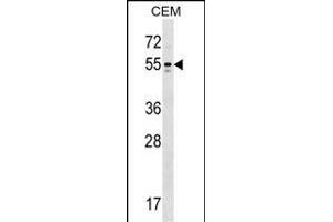KCNA6 Antibody (N-term) (ABIN1538816 and ABIN2848827) western blot analysis in CEM cell line lysates (35 μg/lane). (Kv1.6/KCNA6 抗体  (N-Term))