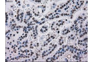 Image no. 13 for anti-TYRO3 Protein Tyrosine Kinase (TYRO3) antibody (ABIN1501607)