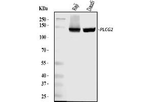 Western blot analysis of PLCG 2/PLCG2 using anti-PLCG 2/PLCG2 antibody (ABIN5692854). (Phospholipase C gamma 2 抗体  (AA 1201-1258))