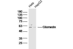 Lane 1: Hela lysates Lane 2: HepG2 lysates probed with Gliomedin Polyclonal Antibody, Unconjugated  at 1:300 dilution and 4˚C overnight incubation. (GLDN 抗体  (AA 365-460))