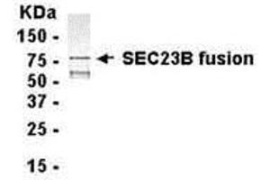 Western Blotting (WB) image for anti-Sec23 Homolog B (SEC23B) (AA 219-530) antibody (ABIN2468160) (Sec23 Homolog B 抗体  (AA 219-530))